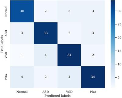 CHD-CXR: a de-identified publicly available dataset of chest x-ray for congenital heart disease